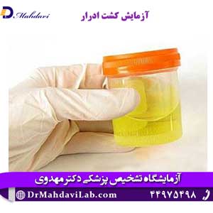 آزمایش-کشت-ادرار 1