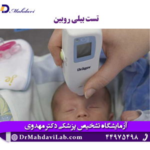 تست-بیلی-روبین