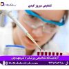 تشخیص سیروز کبدی