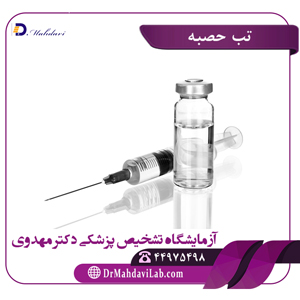 تب حصبه