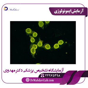 آزمایش ایمونولوژی