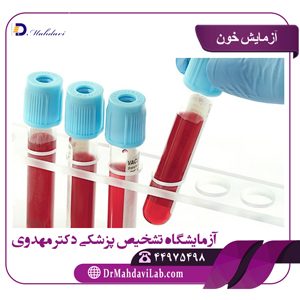 آزمایش خون