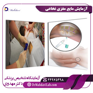 زمایش مایع مغزی نخاعی