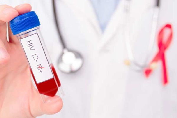 تشخیص ایدز