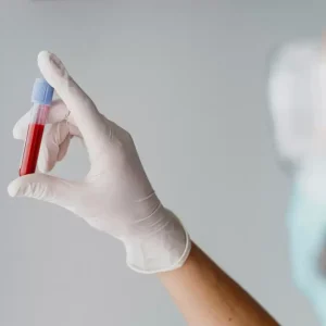 آزمایش خون پلاکتی (PLT): تعداد پلاکت های بالا و پایین به چه معناست