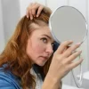 عوارض افزایش آندروژن در زنان