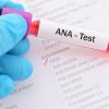 رنج نرمال آزمایش ANA
