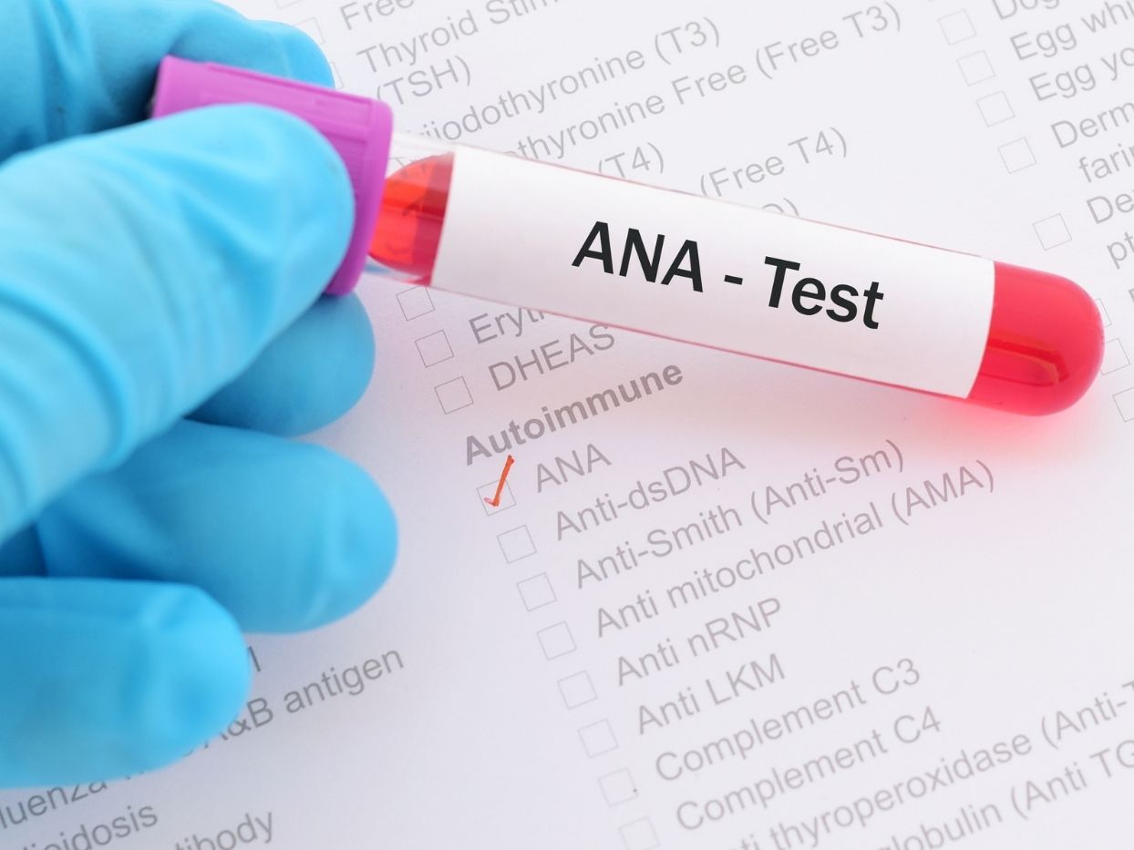 رنج نرمال آزمایش ANA