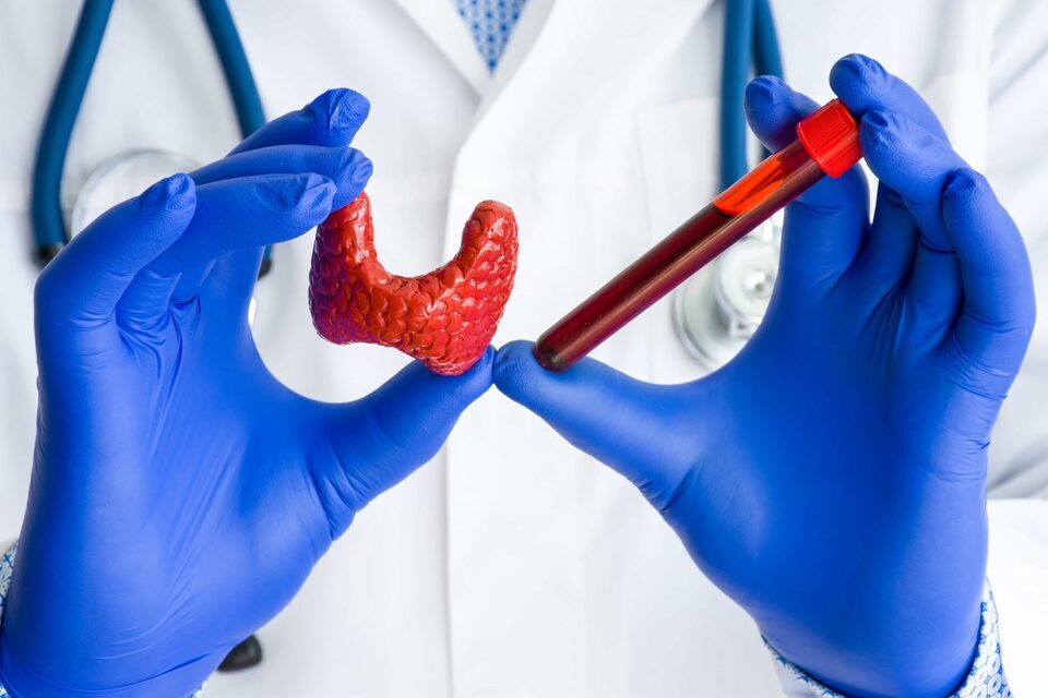 آزمایش تیروئید چگونه انجام میشود؟