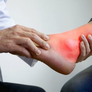 اسید اوریک بالا و درد مفاصل