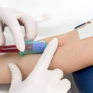 اگر ANA مثبت باشد