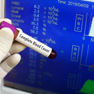 علائم سرطان خون در آزمایش CBC
