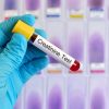 میزان نرمال کراتینین خون در بزرگسالان