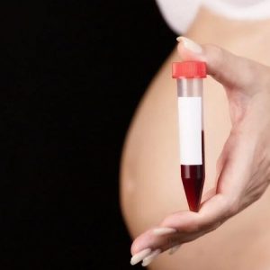 عدد کم خونی در بارداری