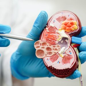 ممنوعات کراتین بالا