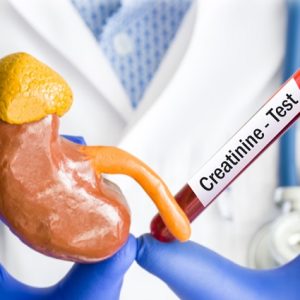 علائم بالا بودن اوره و کراتین