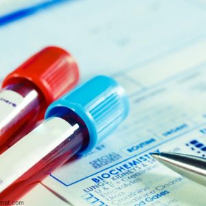 درمان بالا بودن mchc در آزمایش خون