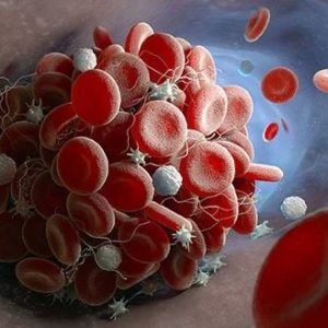 مقدار خطرناک wbc در بارداری