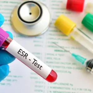 مقدار نرمال esr در زنان چقدر است