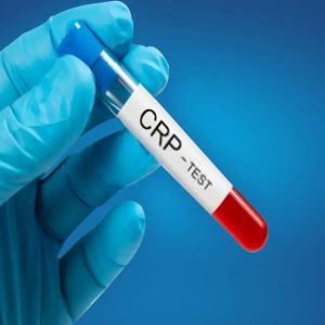 عدد نرمال آزمایش crp نوزاد