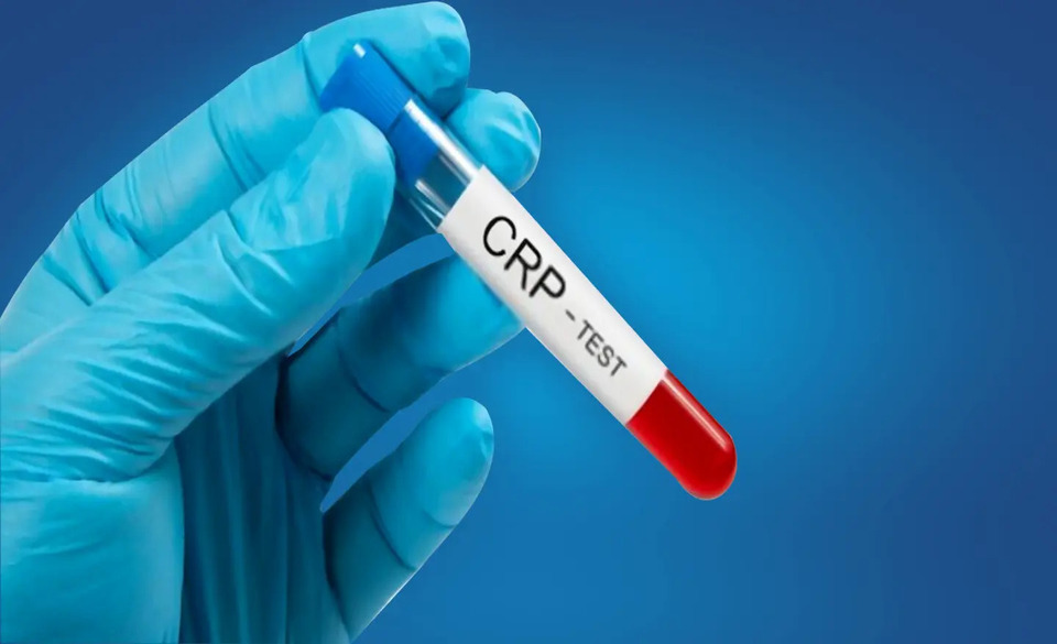 عدد نرمال آزمایش crp نوزاد