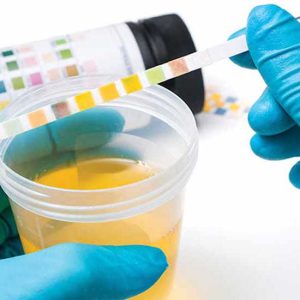 مدت زمان جواب آزمایش کشت ادرار