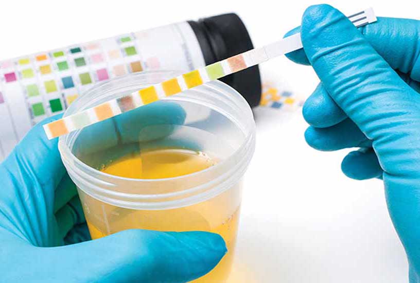 مدت زمان جواب آزمایش کشت ادرار