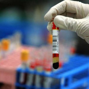 Tsh نرمال چه عددی است