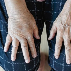 آیا مرغ برای نقرس ضرر دارد