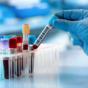 تفسیر آزمایش cd16