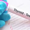 تیروئید پرکار چه عددی است