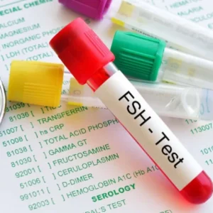 علائم بالا بودن هورمون fsh