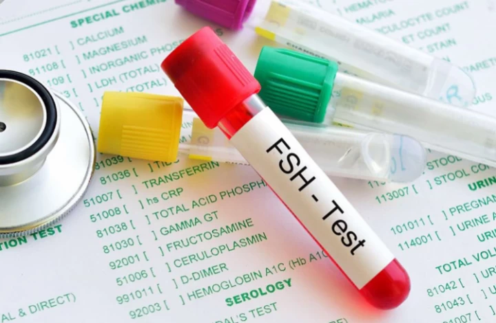 علائم بالا بودن هورمون fsh