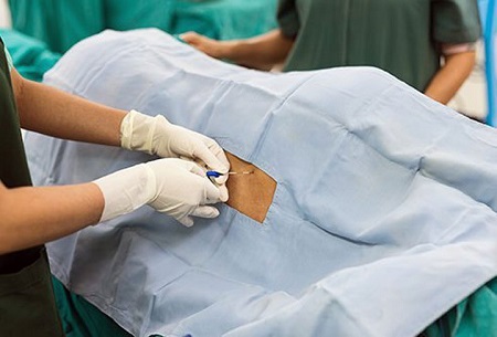 علت نمونه برداری از مایع نخاع